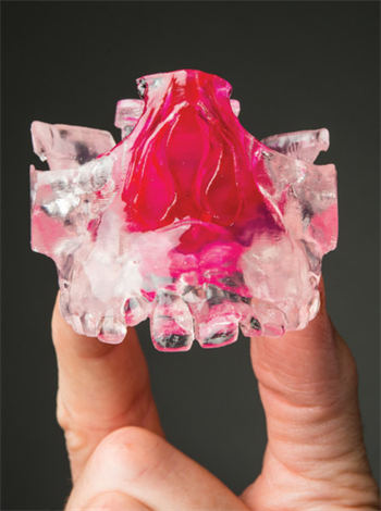 Clinical Orthodontics: A Great Future in Plastics Dr. John Grady details how you can improve communication with OSA patients and practitioners by moving up to CBCT and 3-D printing, and explores managing the airway with rapid maxillary expansion (RME) treatment.