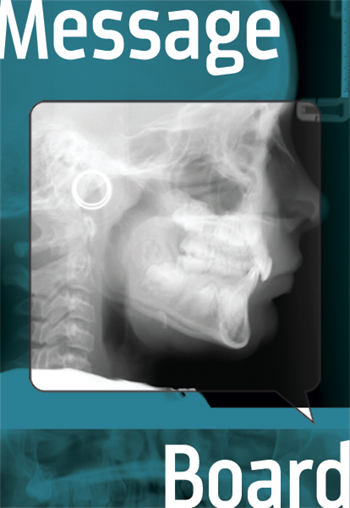 Should I Commit to Extractions? A 9-year-old patient leaves this ortho wondering whether he should extract or monitor.