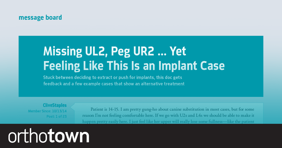 Missing UL2, Peg UR2, Yet Feeling Like This Is an Implant Case To place implants or not to place implants? That is the question for this Townie.