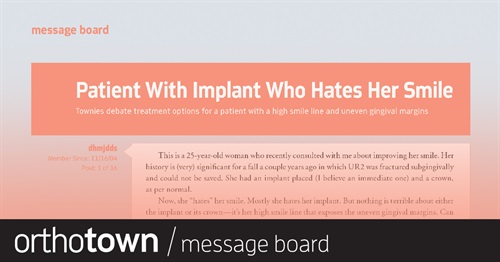 Patient With Implant  Who Hates Her Smile Townies debate treatment options for a patient with a high smile line and uneven gingival margins. 