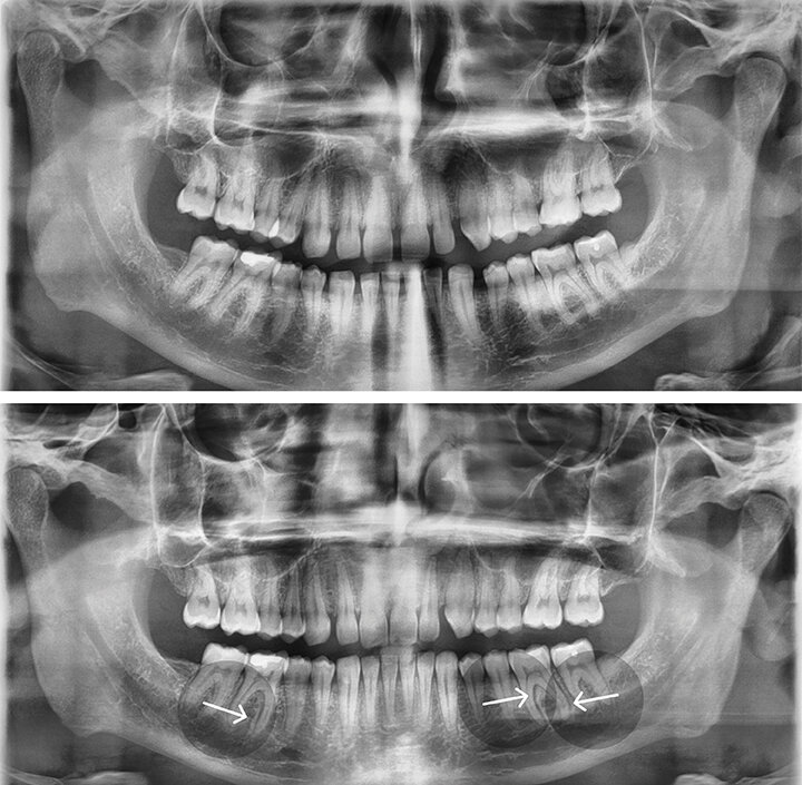 Emerging Principles of Modern Clear Aligner Mechanics