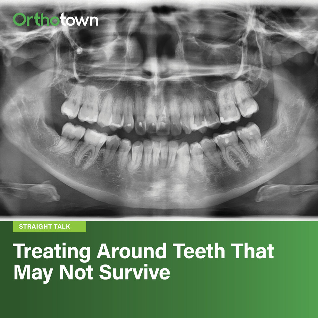 Treating Around Teeth That May Not Survive
