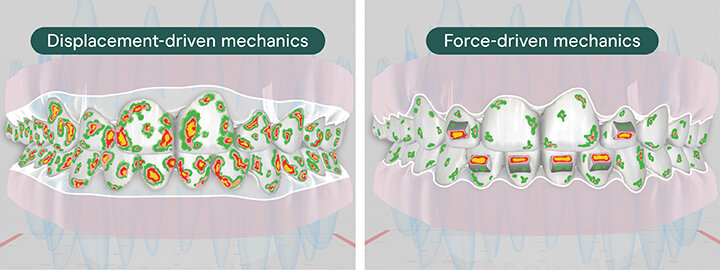 Emerging Principles of Modern Clear Aligner Mechanics