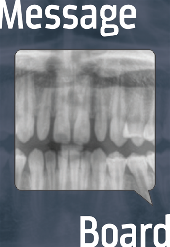 Ankylosed UR6 This Townie asks for advice on how to treat a fused tooth.