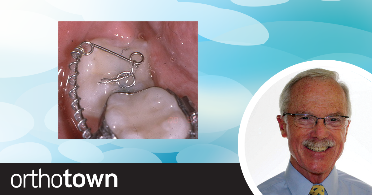 Freeing Impacted Lower Second Molars Dr. Earl Johnson shares his treatment philosophy for deimpacting lower second molars—no surgical flaps or molar extrusion necessary