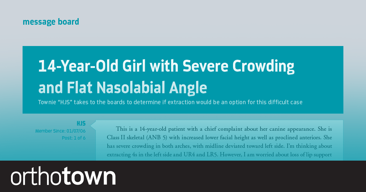 14-Year-Old Girl with Severe Crowding and Flat Nasolabial Angle Townie “HJS” takes to the boards to determine if extraction would be an option for this difficult case.