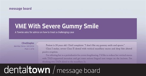VME With Severe Gummy Smile A Townie asks for advice on how to treat a challenging case.