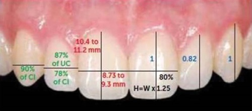 The Finishing Touches Dr. Trevor Nichols covers the art of hard- and soft-tissue sculpting after orthodontic treatment, which can take many ordinary cases to extraordinary through a simple method that requires little time.