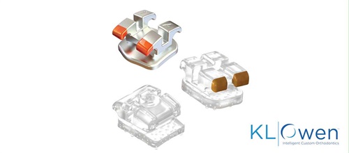 Product Profile: Stride Custom Braces Custom digital orthodontics meets intelligent design
