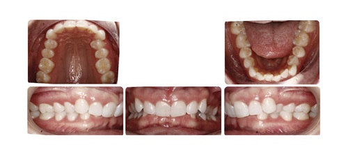 A Voice in the Arena: A Case for 'Outside-In" Editorial director Dr. Chad Foster shares a case in which examining the patient photos and images from “outside-in” led to interesting treatment options.