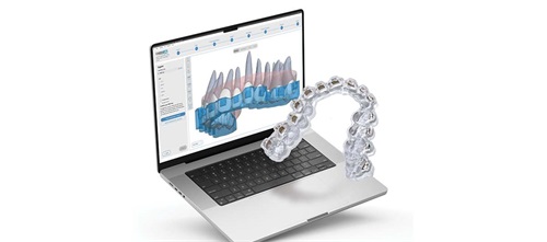 A Smile Transformed Drs. Dustin Burleson and Brandon Simister showcase how 3D printing significantly enhances
orthodontic treatment for a patient with cleft lip and palate, addressing treatment planning, bracket placement, indirect bonding trays and presurgical splint fabrication.