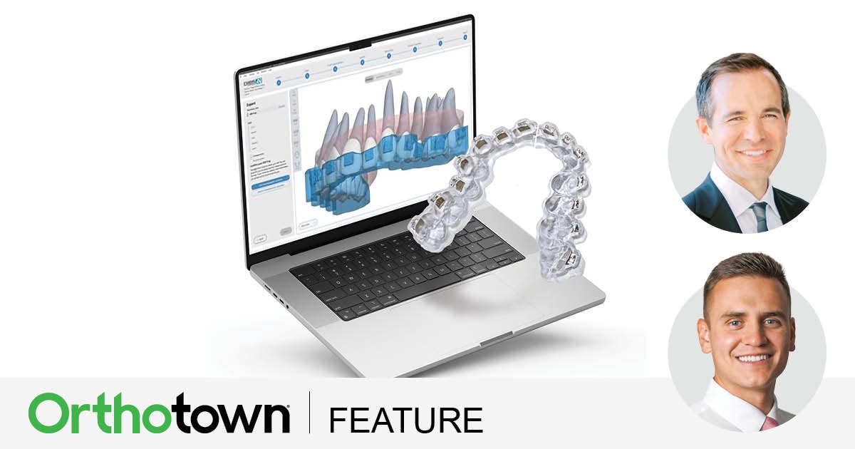 A Smile Transformed Drs. Dustin Burleson and Brandon Simister showcase how 3D printing significantly enhances
orthodontic treatment for a patient with cleft lip and palate, addressing treatment planning, bracket placement, indirect bonding trays and presurgical splint fabrication.