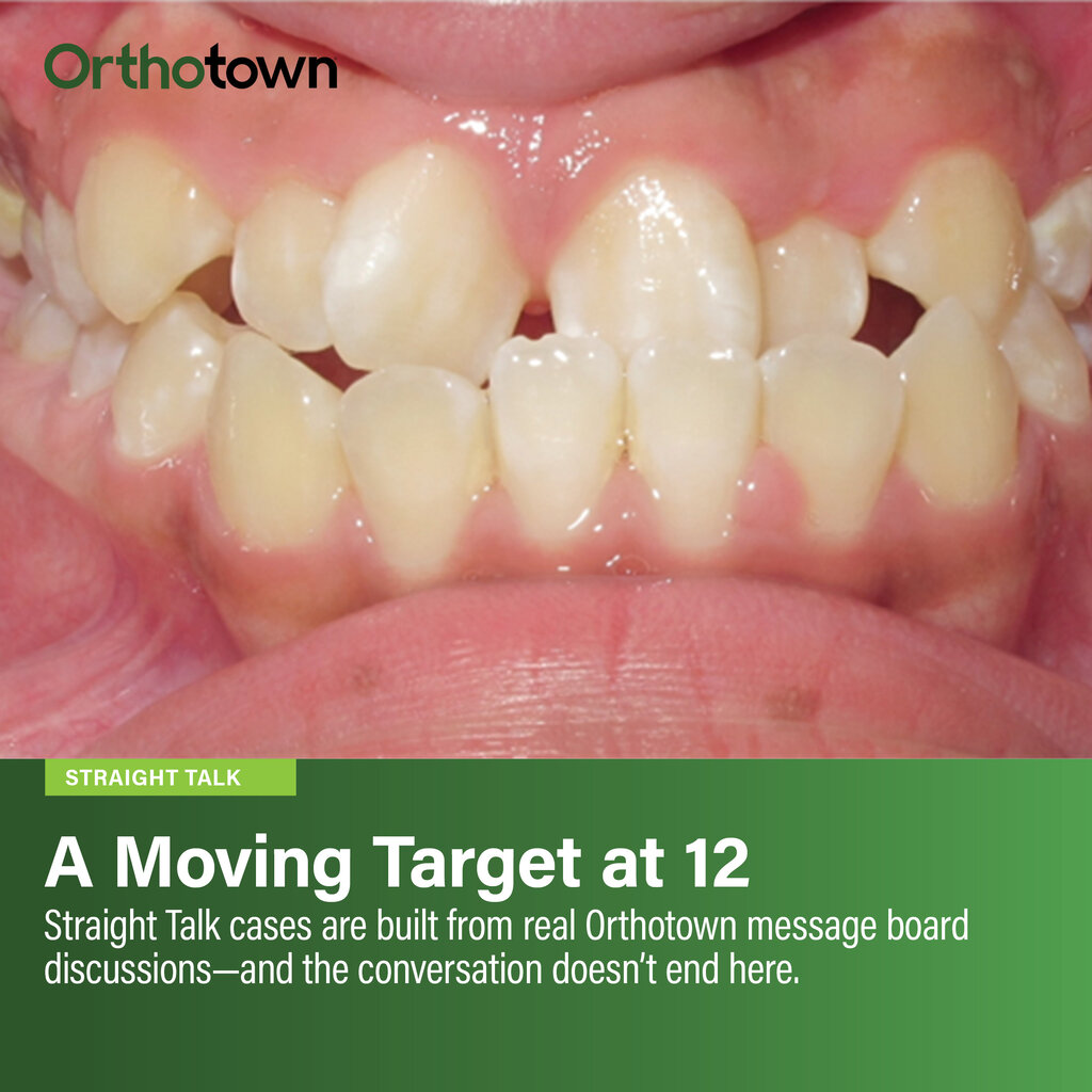 A Moving Target at 12: Weighing treatment timing in a growing Class III A nearly 13-year-old with a significant Class III discrepancy sparks a debate over extractions, growth prediction, and whether the smartest treatment decision is to wait.