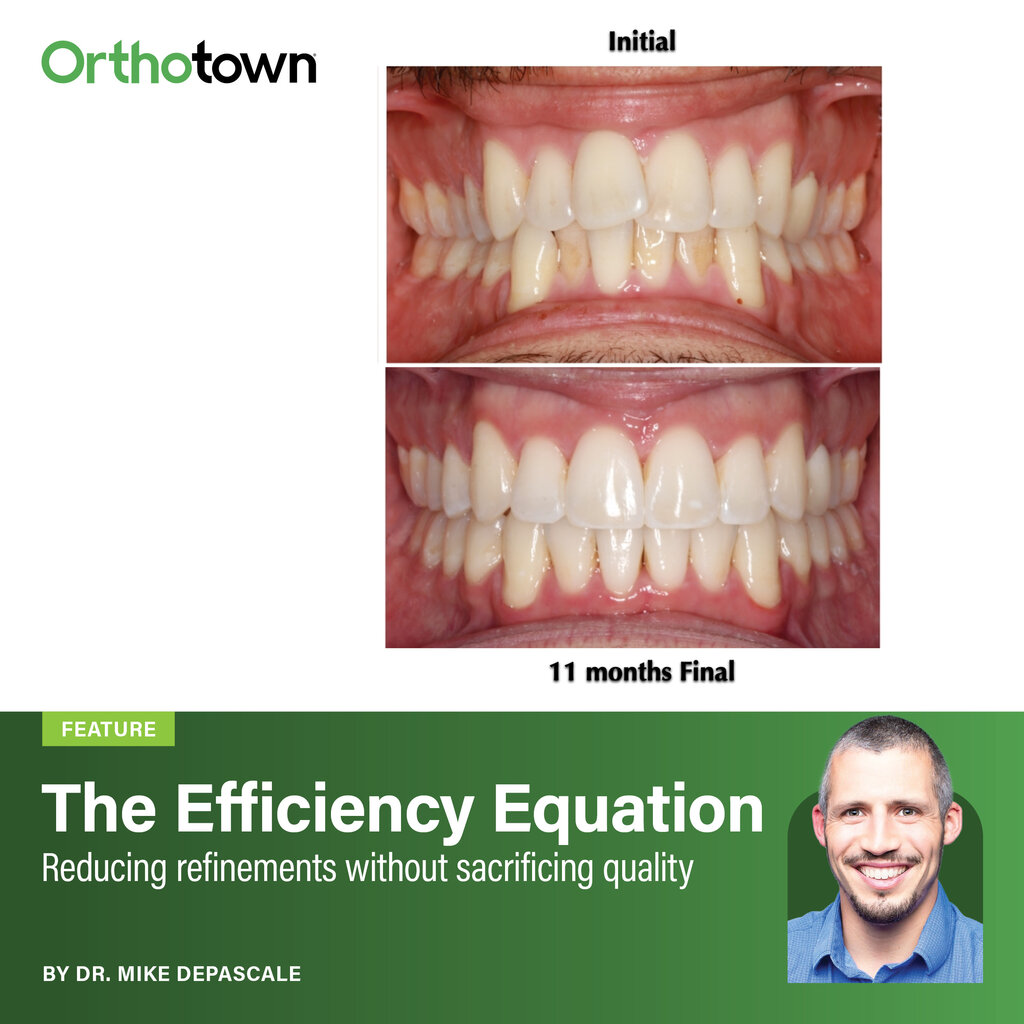 The Efficiency Equation Dr. Mike DePascale shares the treatment-planning protocols behind his practice’s low-refinement aligner outcomes, showing how better diagnosis cuts appointments without sacrificing quality.