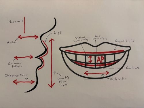 A Voice in the Arena: The Outside-In Template: Part 2