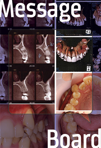Message Board: Dilaceration  A Townie wonders which teeth to extract in a case with dilacerations.