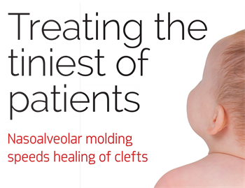 Treating the Tiniest of Patients Dr. Dustin Burleson of Burleson Orthodontics & Pediatric Dentistry discusses how nasoalveolar molding helps babies with cleft lips and palates.
