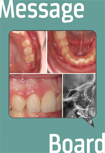 Nonsurgical Orthodontic Treatment Townie "HappyOrthoD" has a young patient who could use treatment planning - and surgery could be an option. Is it called for in this case?