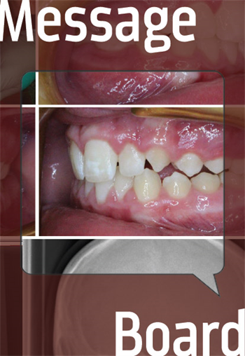 Asymmetric Mandible in 12-Year-Old A case with no easy solution has Townies divided on how to treat this young patient in the short term and in the long term.