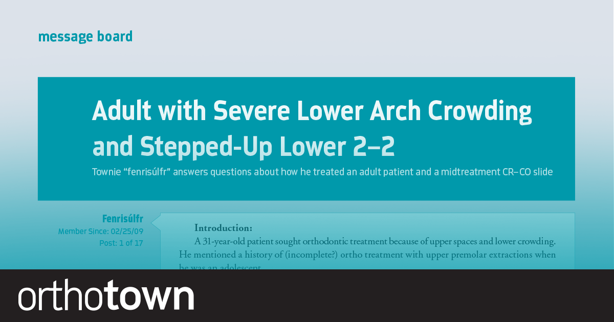 Adult with Severe Lower Arch Crowding and Stepped-Up Lower 2-2 Townie “Fenrisúlfr” answers questions about how he treated an adult patient and a midtreatment CR–CO slide.