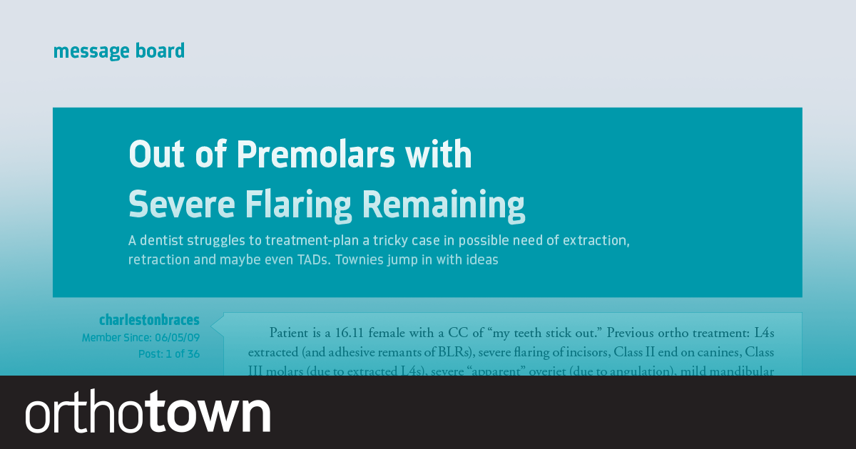 Out of Premolars with Severe Flaring Remaining A doc struggles to treatment-plan a tricky case in possible need of extraction, retraction and maybe even TADs. Townies jump in with ideas.