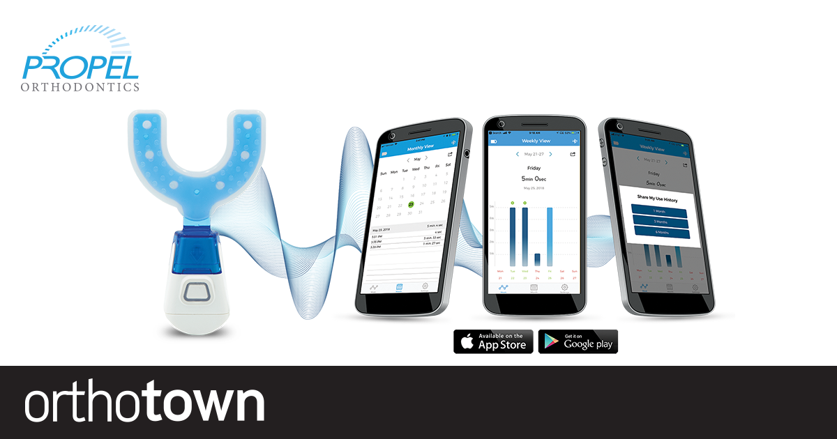 Product Profile: VPro+ Improve the orthodontic experience