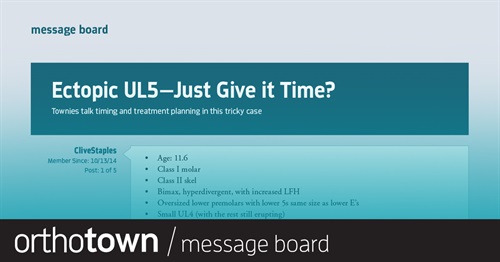 Ectopic UL5—Just Give It Time? Townies talk timing and treatment planning in this tricky case.