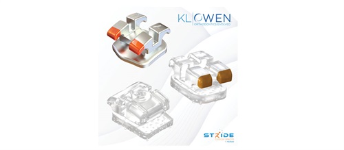 Product Profile: Stride Custom Braces Custom digital orthodontics meets intelligent design
