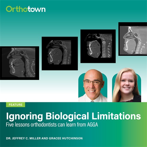 Ignoring Biological Limitations Dr. Jeffrey Miller and Gracee Hutchinson share five lessons orthodontists can learn from Anterior Growth Guidance Appliances, revealing how the device’s claims and misuse
led to devastating bone loss.
