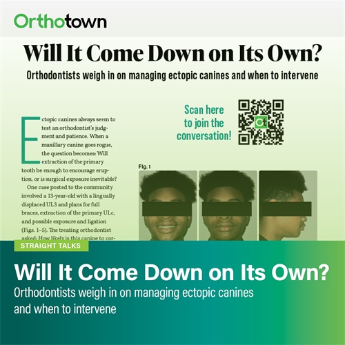 Will It Come Down on Its Own? Orthodontists weigh in on managing ectopic canines and when to intervene