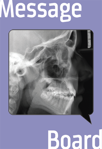 Class III Case with Lost Space for Upper Canine - Treatment Options Before this Townie starts treatment, he asks for advice on how to proceed.