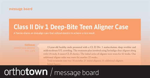 Class II Div 1 Deep-Bite Teen Aligner Case A Townie shares an Invisalign case that utilized elastics to achieve a nice result.