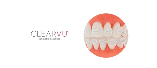 Product Profile: ClearVu Cosmetic Brackets Innovative design for clinicians and patients