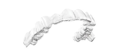 Going It Alone Orthotown editorial advisory board member Dr. Donna Galante shares a case study of correcting a moderate to severe Class II malocclusion using clear aligners with special mandibular advancement features instead of elastics. 