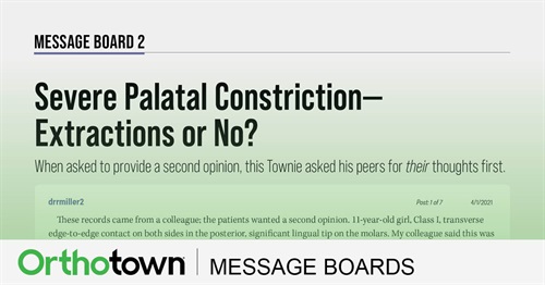Severe Palatal Constriction— Extractions Or No? When asked to provide a second opinion, this Townie asked his peers for their thoughts first.