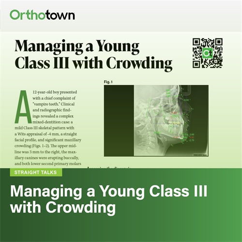 Managing a Young Class III with Crowding A 12-year-old patient with significant maxillary crowding and a mild Class III skeletal pattern prompted a discussion about managing complex mixed-dentition cases and setting the stage for long-term stability.