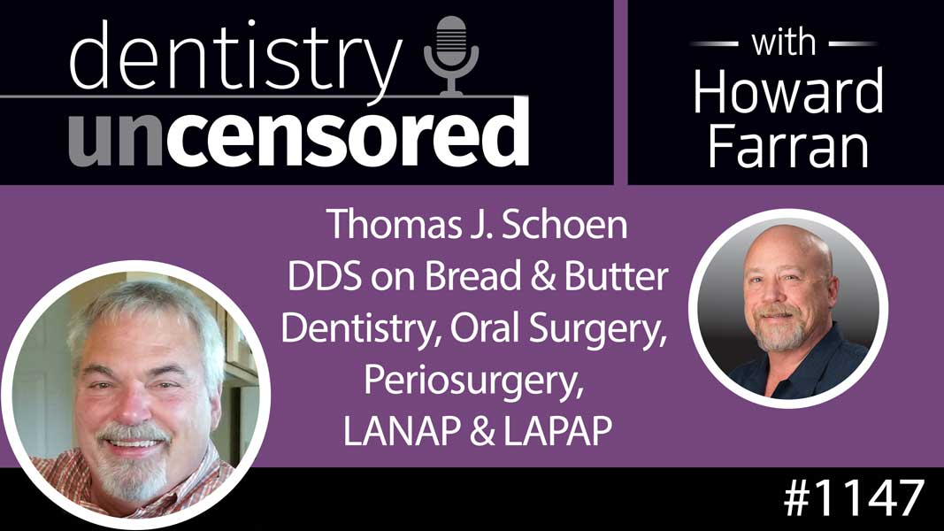 1147 Thomas J. Schoen DDS on Bread & Butter Dentistry, Oral Surgery, Periosurgery, LANAP & LAPAP : Dentistry Uncensored with Howard Farran